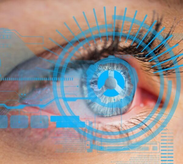 Corneal Cross-Linking